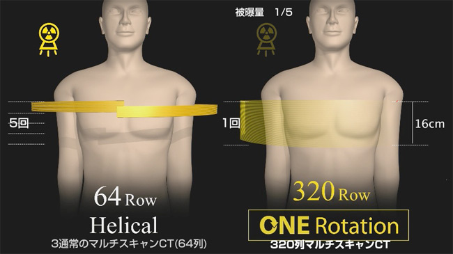 320列心臓CTスキャン