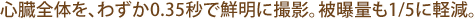 心臓全体を、わずか0.35秒で鮮明に撮影。被曝量も1/5に軽減。